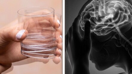 Parkinson'un erken belirtileri nelerdir? Hastalığı atlatmak mümkün mü? - Sağlık