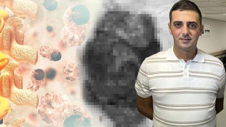 2,5 milyonda bir görülüyor… Geçmeyen kuru öksürüğünün nedeni meğer dev tümörmüş - Sağlık