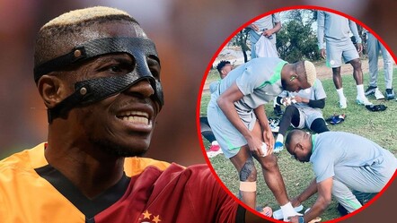 Victor Osimhen'in görüntüsü Galatasaraylıları korkuttu: Büyük tepki - Spor