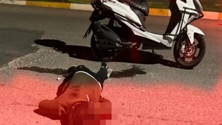 Şanlıurfa’da kan donduran saldırı: Sırtında bıçakla hastaneye koştu! - 3. Sayfa