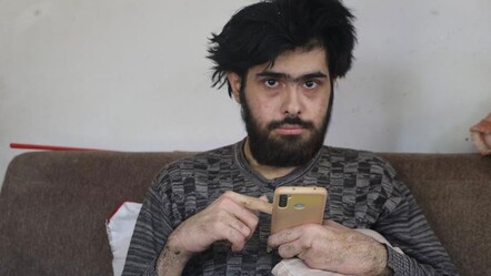 Ne duş alıyor ne tırnaklarını kesiyor… Telefon bağımlısı gencin eski hali ortaya çıktı - Yaşam