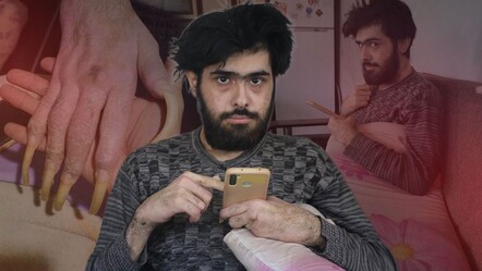Ne duş alıyor ne tırnaklarını kesiyor… Telefon bağımlısı gencin eski hali ortaya çıktı - Yaşam
