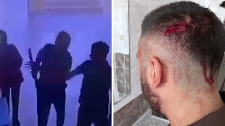Şanlıurfa'da veli, öğretmene demir sopayla saldırdı! Kan revan içinde kaldı, canını zor kurtardı - 3. Sayfa