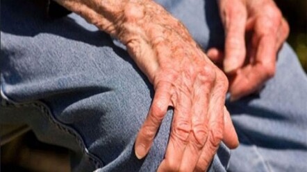4 kişiden birinde osteoporoz var! Kemik karnemiz zayıf - Sağlık