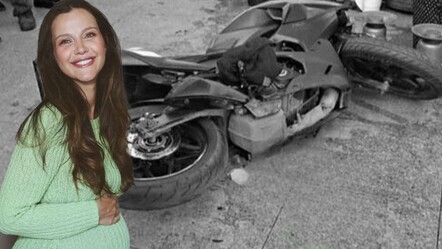 İrem Helvacıoğlu’nun başına 12 dikiş atılmıştı! İşte korkunç kazanın görüntüleri - Magazin