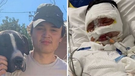 Sokak ortasında dehşet! Hiç tanımadıkları gencin üzerine yanıcı madde döküp ateşe verdiler - Dünya