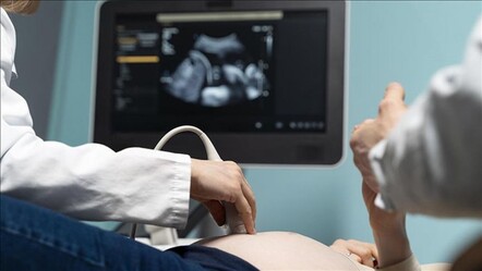 Dünya doktorları müjdeyi İstanbul'dan verdi: Kısırlığın çözümü laparoskopide aranıyor - Sağlık
