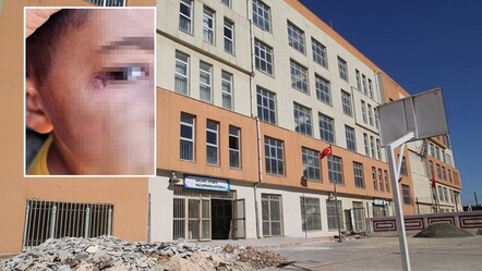 Şanlıurfa'da temizlik görevlisi, öğrenciyi darbedip yüzünde sigara söndürdü! - 3. Sayfa