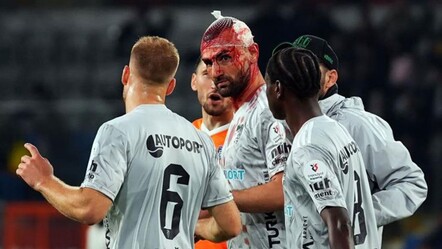 Serdar Dursun yürekleri ağza getirdi: Kanlar içinde kaldı - Spor