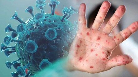 Avrupa’dan Afrika’ya sessizce yayılıyor! 'Her 100 kişiden birini öldürebilir' - Dünya