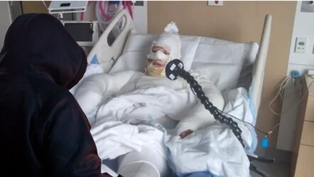 Avustralya'da korkunç saldırı! Otoparka molotof kokteyli fırlatıp kaçtı: Kızartılıyormuş gibi hissettim - Dünya