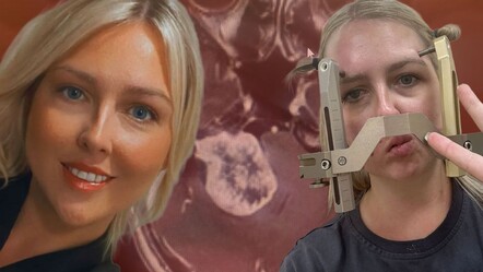 Baş ağrısını yıllarca hafife aldılar! Gördüğü ‘küçük kurtlar’ gerçek sorunu ele verdi - Sağlık