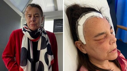 Doktorlar menopoza bağladı, 3 yıl boyunca teşhis konulamadı! Acı gerçek sonunda ortaya çıktı - Sağlık