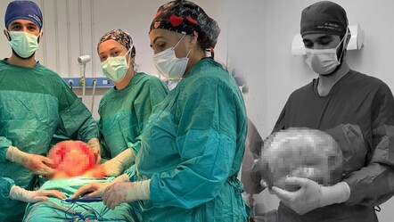 Sadece 2 ayda 9 aylık hamilelere döndü! Gerçek ortaya çıkınca büyük şok yaşandı - Sağlık