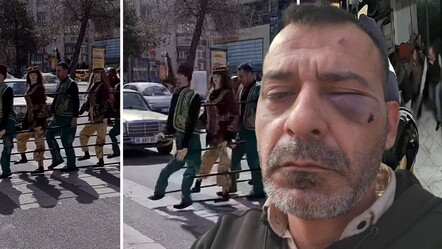 Sosyal medya fenomenine dehşeti yaşattılar! Adem Ocaktan ve 13 yaşındaki oğluna korkunç saldırı - 3. Sayfa