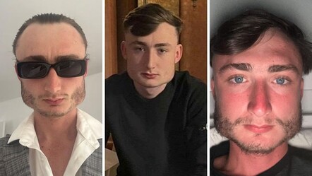 Sosyal medya onu konuşuyor! Yaptığı spor yüzünün şeklini değiştirdi - Dünya