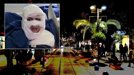 Kadıköy’de dehşet anları: Genç kadın başka bir kadın tarafından ateşe verildi! - Gündem