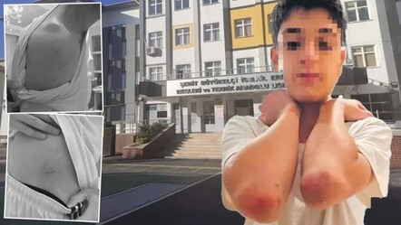 Lisede ördek yürüyüşü skandalı! Sözde 'disiplin cezası' öğrencileri hastanelik etti - Gündem