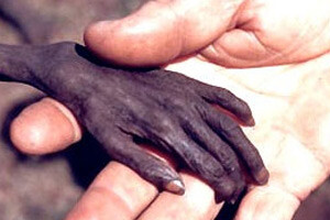 Türkiye dünyanın en yardımsever 4. ülkesi - yasam