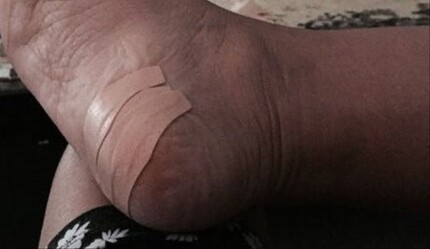 Demet Akalın'ın ayağına cam battı - EDİTÖRÜN SEÇTİKLERİ