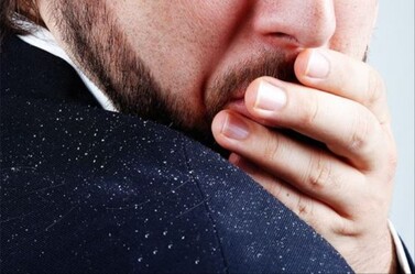 Az su içmek kepekleri artırıyor - yasam