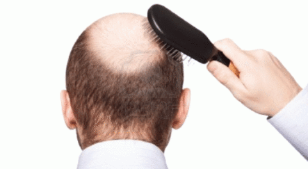 Maydanoz kelliği önlüyor mu? - saglik