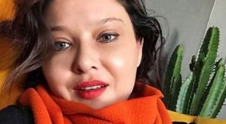 Nurgül Yeşilçay'ın botoks sonrası son hali şaşırttı - magazin