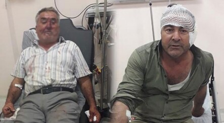 Akrabasının kulağını kopardı! Sebebini duyan şoka girdi - dunya