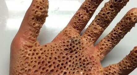 Bu fotoğrafa bakamıyorsanız dikkat! Tripofobi (delik korkusu) nedir? - SAĞLIK