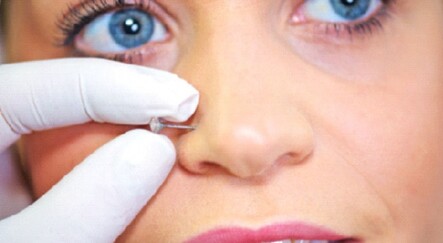 Piercing yüzünden burnunuzu kaybedebilirsiniz - dunya