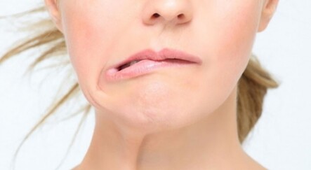 Soğuk ve rüzgarlı havalar yüz felcine davetiye çıkarıyor - saglik