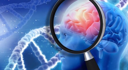 Beyin kanserinde umut veren ilaç - saglik