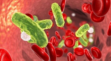 'Sepsiste erken tanı ve tedavi çok önemli' - saglik