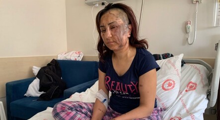 Boşanmak isteyen eşine kezzapla saldırdı - gundem