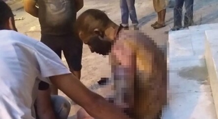 Üzerine tiner dökülerek yakıldı! - dunya