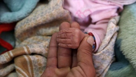 Sudan ve Yemen'de çocuk felci salgını yayılıyor - dunya