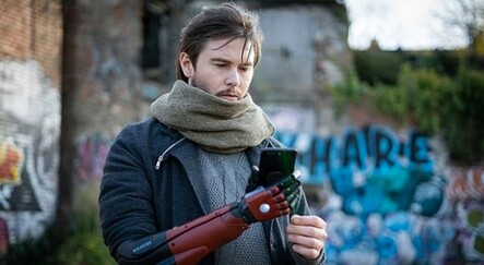 Doğuştan bir eli olmayan adam kendine bilgisayar oyunundaki gibi biyonik kol yaptırdı - yasam