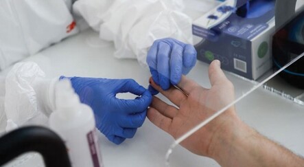 Kan testiyle Alzheimer 4 sene önceden tahmin ediliyor - saglik