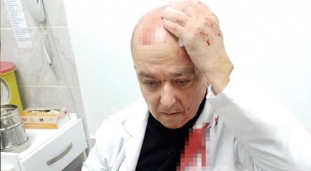 Doktorun kafasını taşla yarmıştı...  Adli kontrol şartıyla serbest bırakıldı - gundem