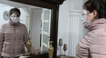 Kazada göz kapağını kaybeden genç kız ameliyat olup aynalarla barışmak istiyor - saglik