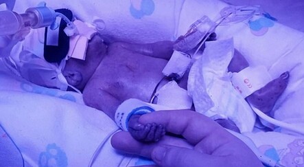 Prematüre bebek 2 ayda E.coli, sepsis ve Covid-19 geçirdi - saglik