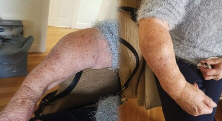 İngiltere’de sağlık skandalı! 18 aydır kırık kolla acılar içinde kıvranıyor - dunya