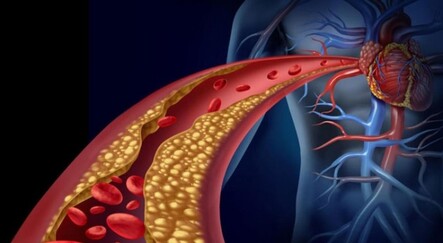 Yüksek kolesterollü hastalara yeni umut: Kolesterol aşısı - saglik