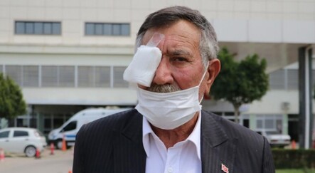 50 kuruşluk tuvalet parası için gözünden oldu - yasam