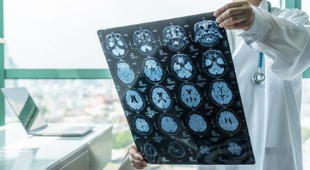 Az uyuyanlara kötü haber: Bunama riski yüzde 30 artıyor - teknoloji
