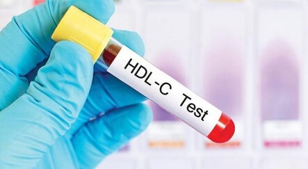 İyi kolesterolün içeriği de önemli - saglik