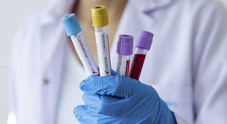 Lancet: Covid geçirenler yeniden enfekte olabilir - dunya