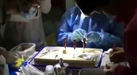 Wuhan'da yarasaların uzmanları ısırdığı anlar ortaya çıktı - dunya