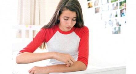 Deri yolma hastalığı ergenlikte başlıyor - saglik