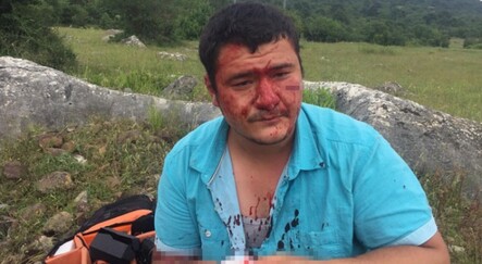 İHA muhabirine saldıran 4 şüpheliden biri tutuklandı - gundem